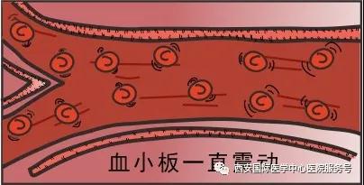 血小板是正常值的三倍？專家提醒小心血栓和出血！