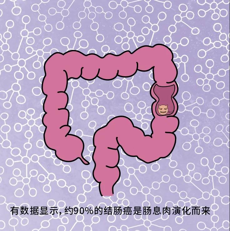 奪走“黑豹”生命的結(jié)腸癌，到底什么來頭？