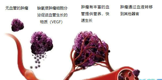 晚期腫瘤為什么會(huì)復(fù)發(fā)轉(zhuǎn)移？