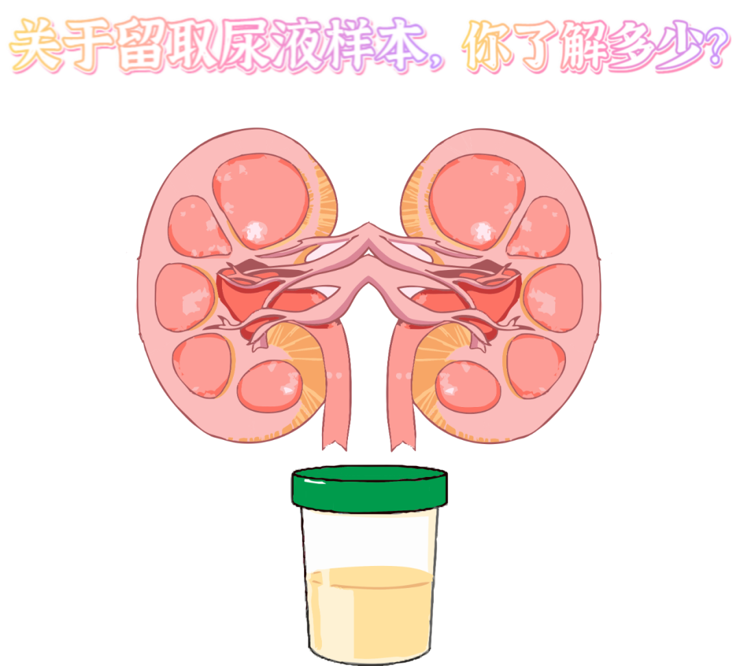 做尿檢，不得不說的注意事項(xiàng)！