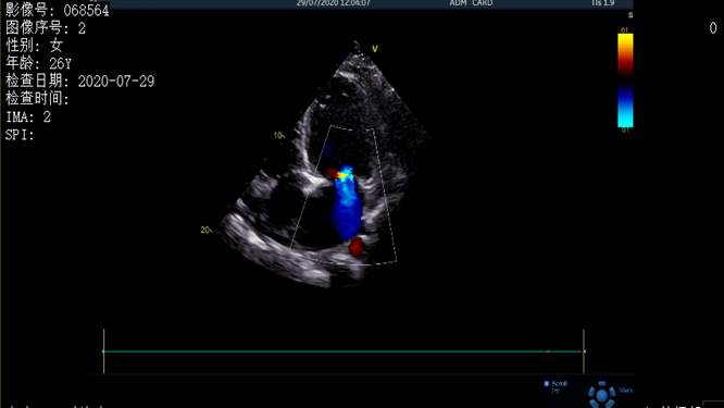 心電圖異常，心臟卻沒(méi)事，罪魁禍?zhǔn)资恰?>
				             </a>
                <div   id=