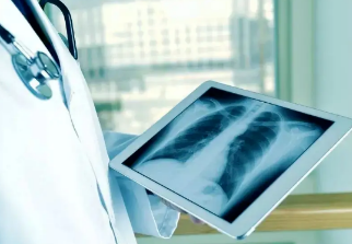 健康呼吸④體檢發(fā)現(xiàn)肺結節(jié)，我該怎么辦？