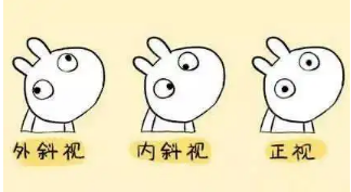 小baby老歪著頭？警惕斜頸! 這樣糾正……