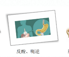 關(guān)愛(ài)身體健康，輕松檢查胃腸