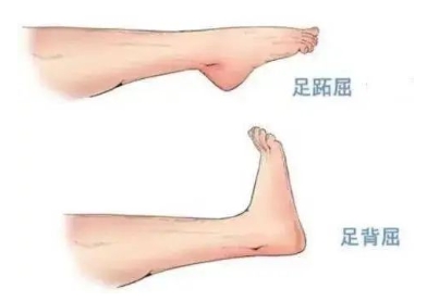 扭胯小連步、動感搖花手……“科目三”雖火，運動損傷也要防！